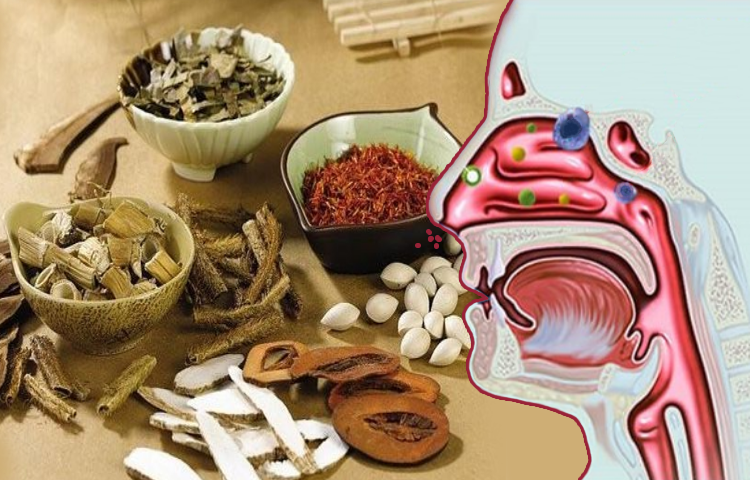 Điều trị viêm mũi do vận mạch và dị ứng theo Y học cổ truyền